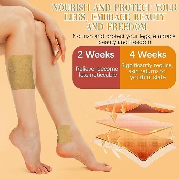 Turmeric Varicose Vein Patch (Pack of 20) – Natural Relief for Pain, Swelling & Circulation